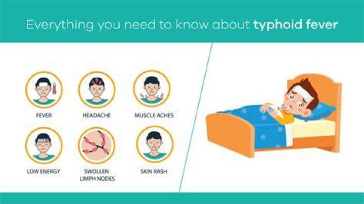 What is another name for typhoid?