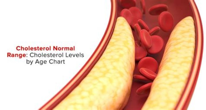 What is normal cholesterol for a 70 year old?