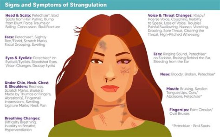 What is strangulation charge?