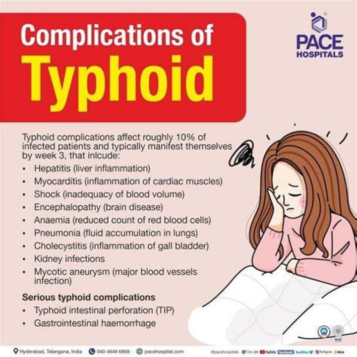 What is the best cure for typhoid?