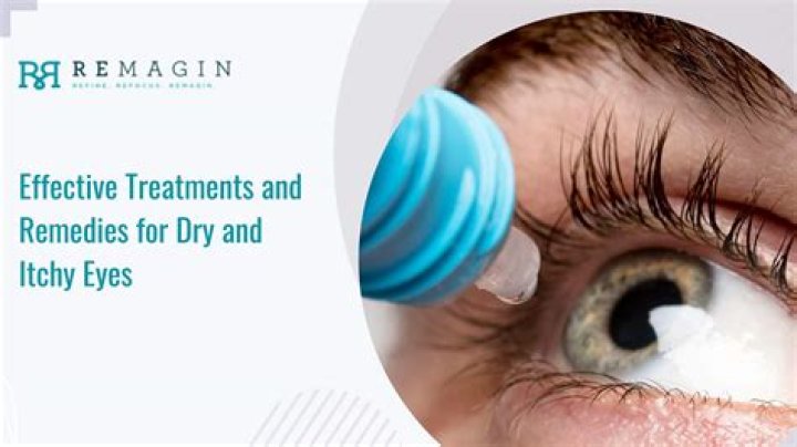 What is the best home remedy for dry eyes?