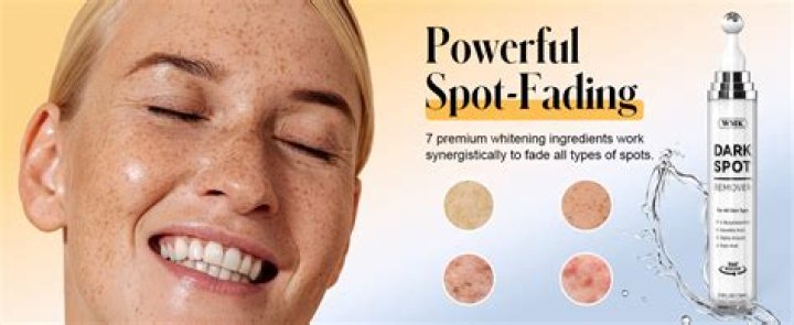 What is the best product to remove age spots on face?