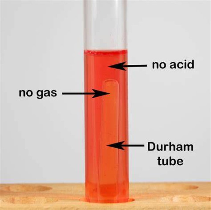 What is the Durham test?