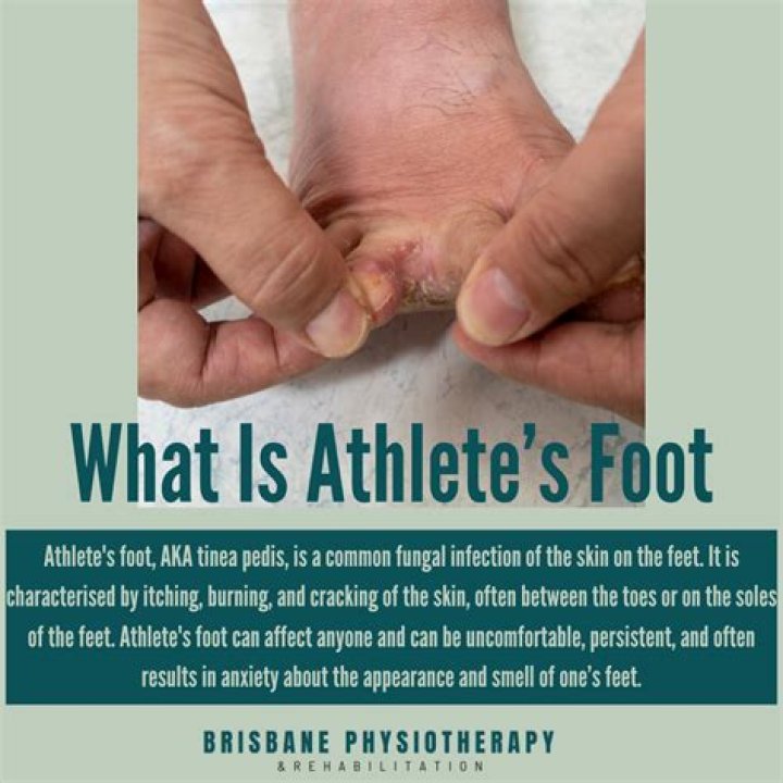 What is the elite athlete gene?