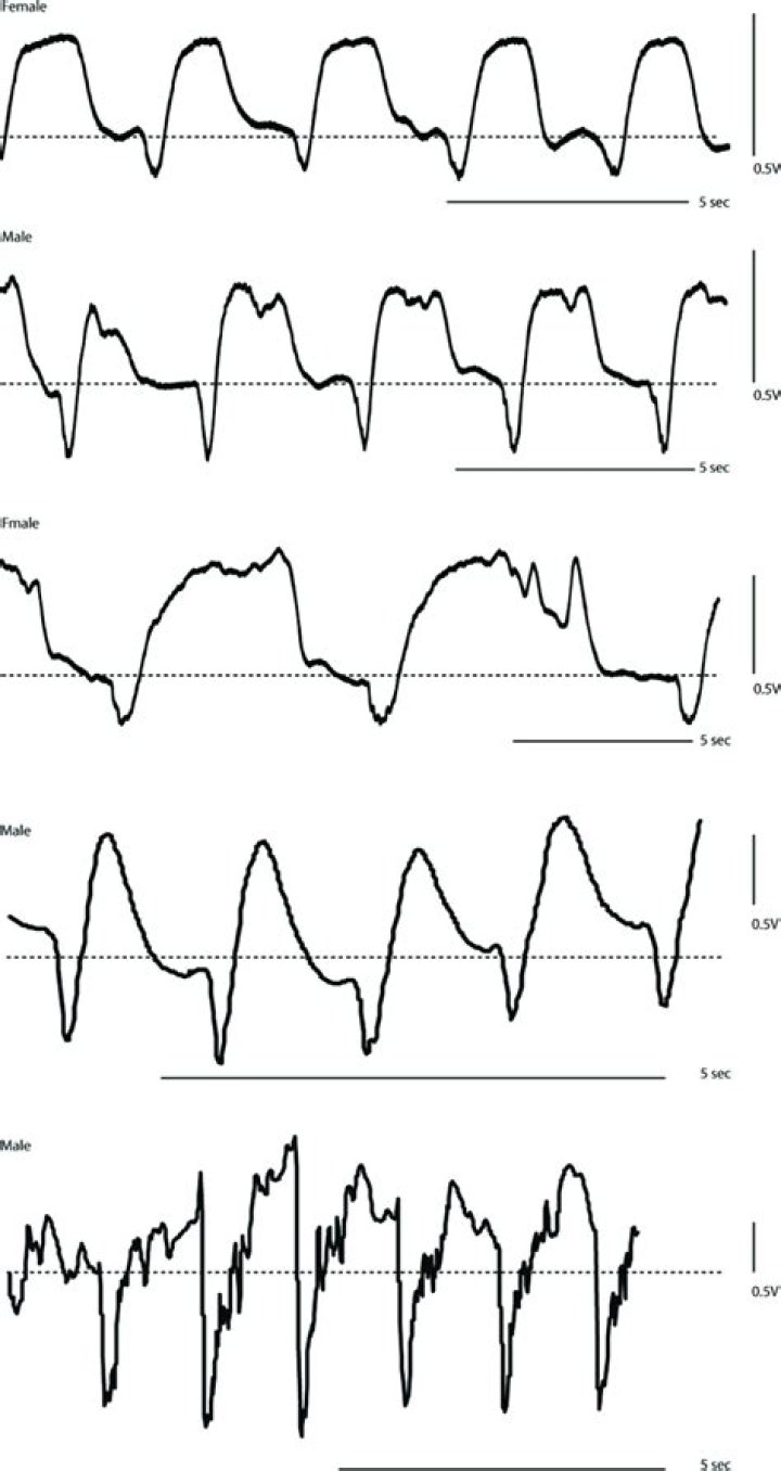 What is the normal breathing pattern?