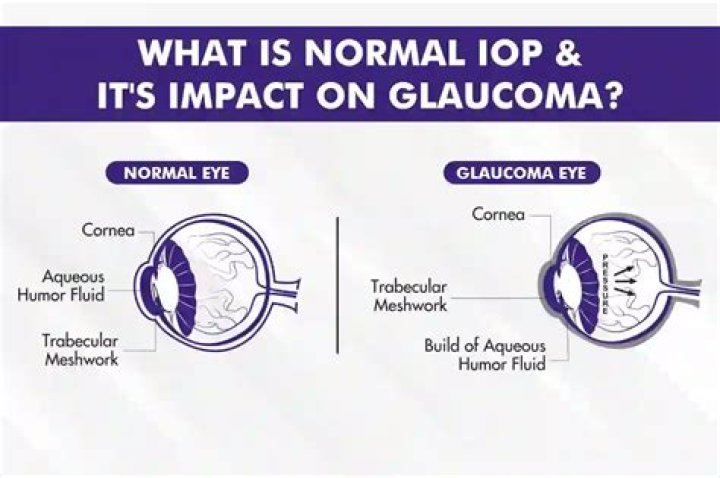 What is the normal eye power?