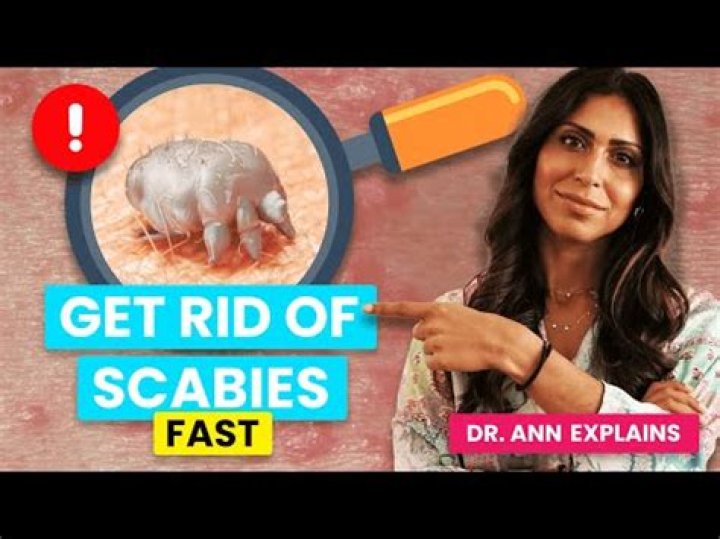 What is the strongest treatment for scabies?