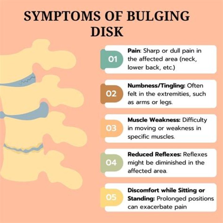What is the VA rating for bulging disc?