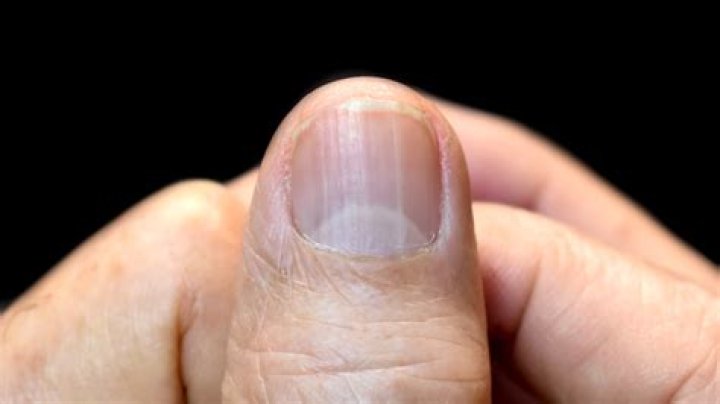 What is the white things on my nails?