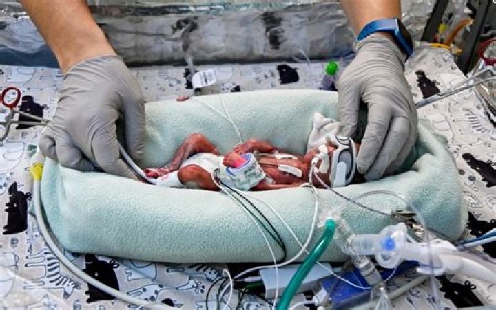 What is the youngest baby ever born and survived?