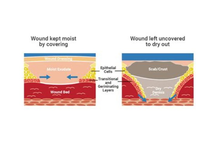 What keeps a wound moist?