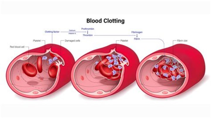 What medications can cause blood clots?