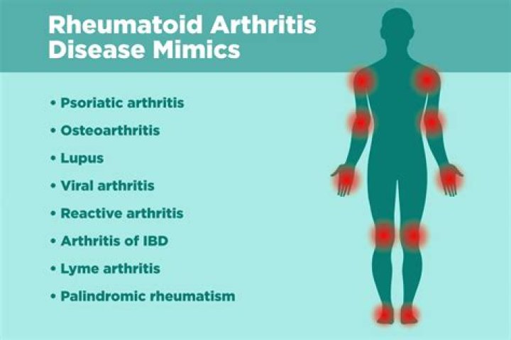 What mimics rheumatoid arthritis?