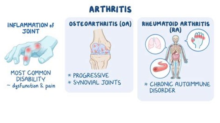 What should I do if I suspect rheumatoid arthritis?