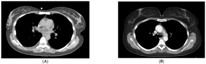 What will a head CT show?
