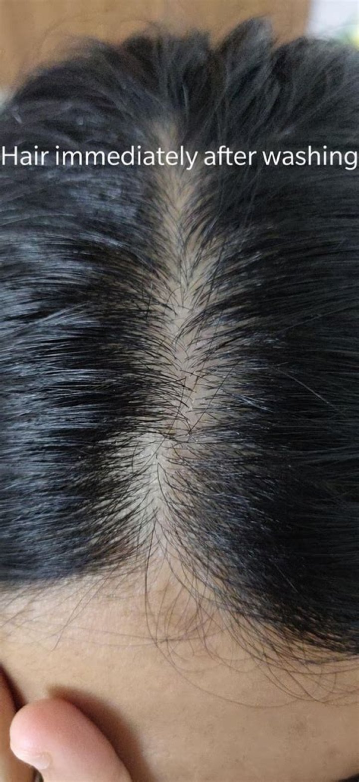When I scratch my hair white stuff?