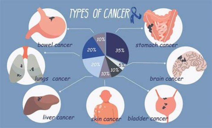 Where do female cancers like to be touched?