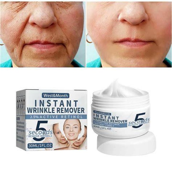 Which cream is best to remove wrinkles?