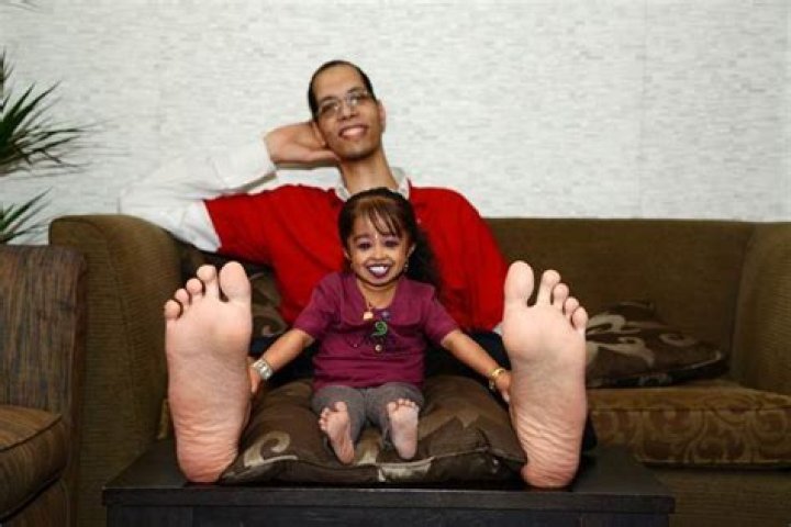 Who has the smallest feet in the world?