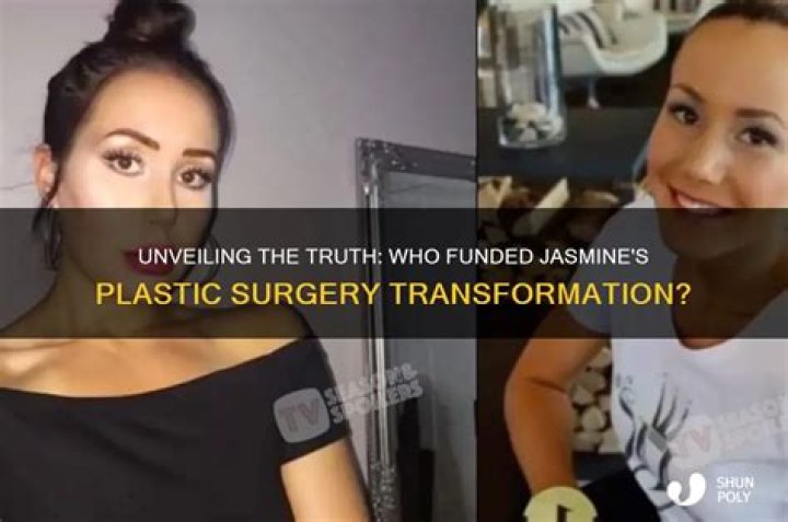 Who paid for Ximena plastic surgery?