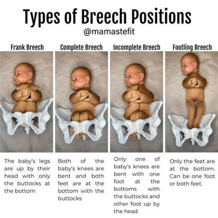 Why are babies held upside down after birth?