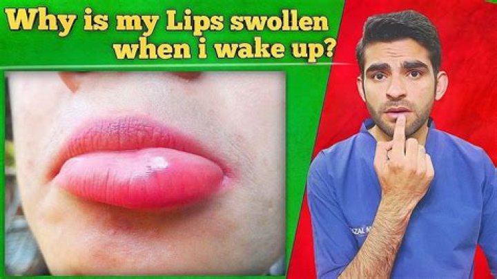 Why are my lips crusty when I wake up?