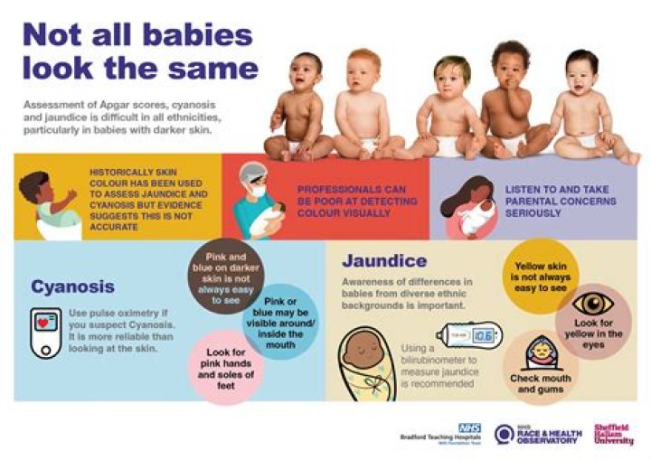 Why do babies get stuck in Labour?