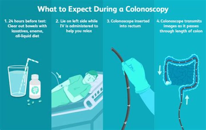 Why do doctors push colonoscopy?