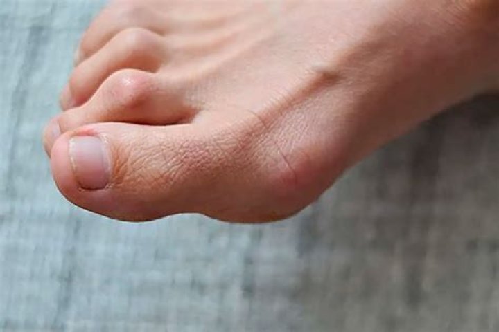 Why do I naturally walk on my toes?