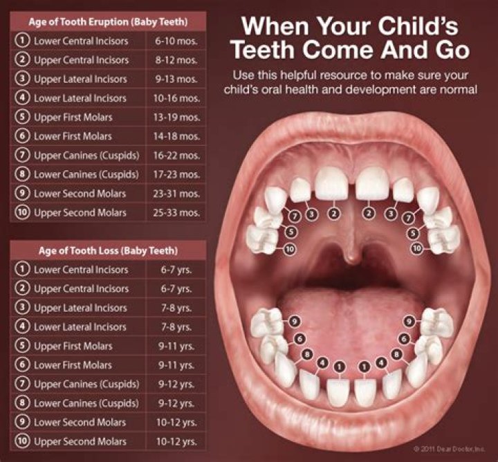 Why do I still have a baby tooth at 15?