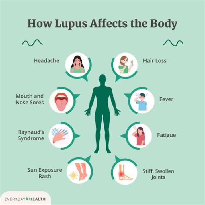 Why do my legs hurt with lupus?