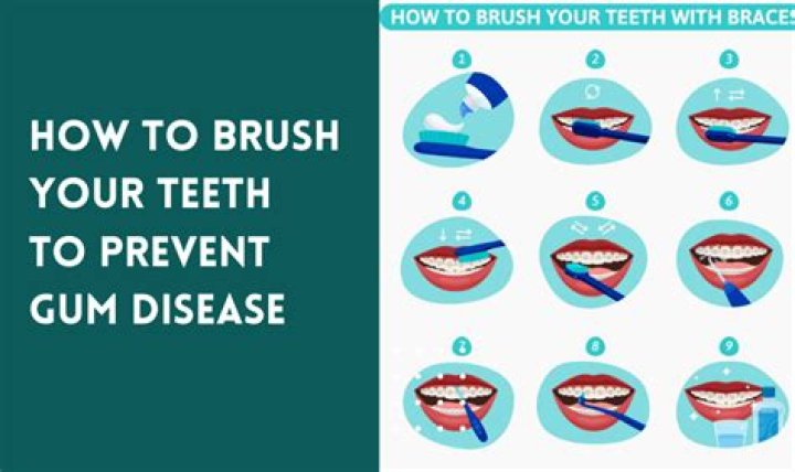 Why do my teeth squeak when brushing?