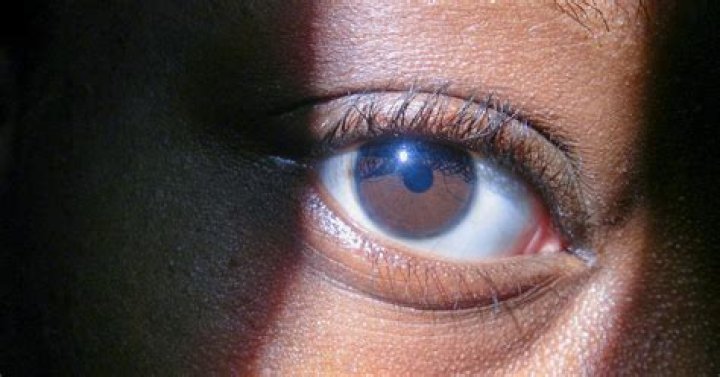 Why do old people's eyes turn blue?