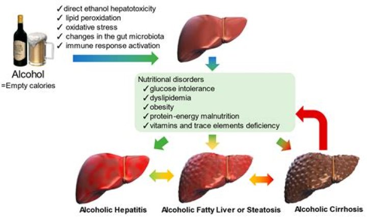 Why do some heavy drinkers not get cirrhosis?