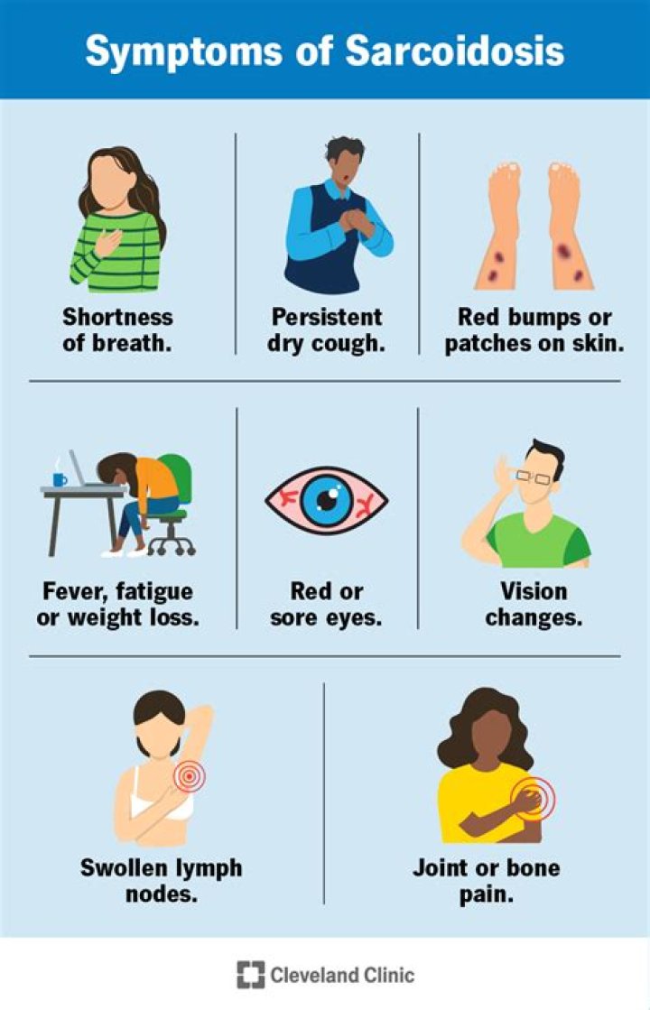 Why do you cough with sarcoidosis?
