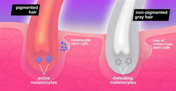 Why does hair lose melanin?