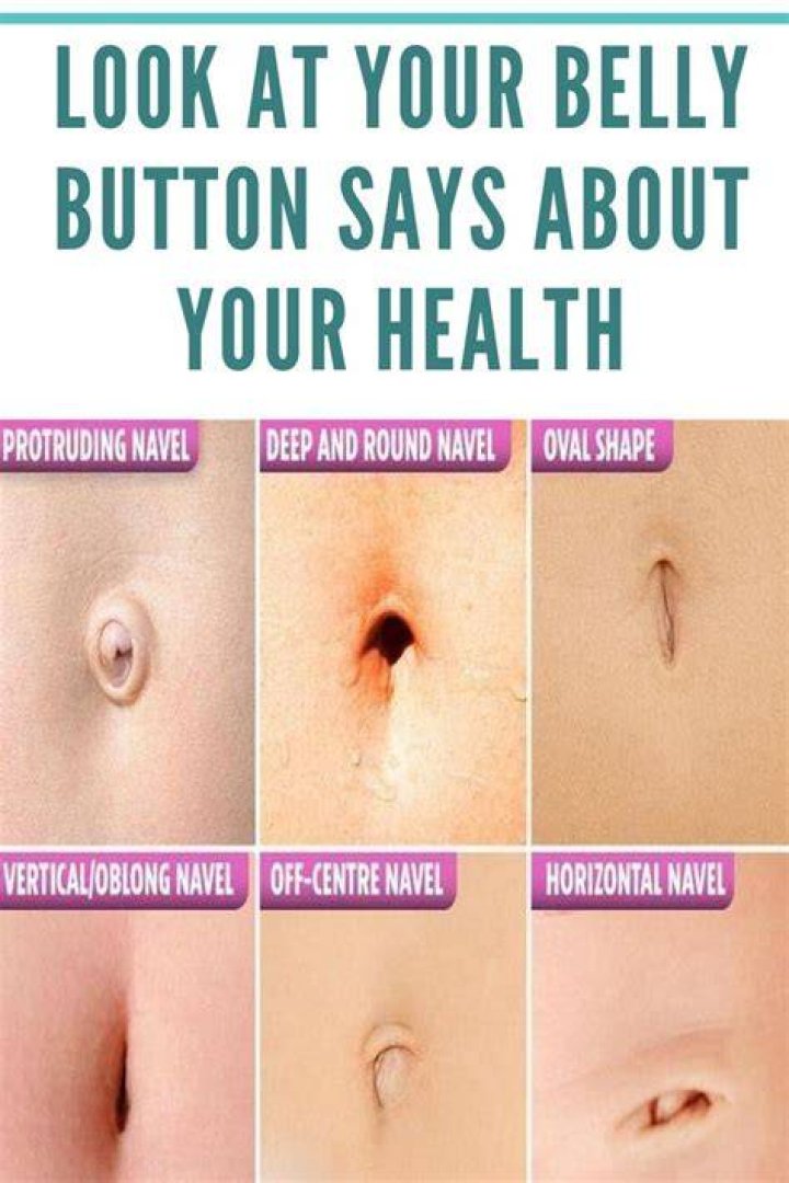 Why does my belly button have discharge?