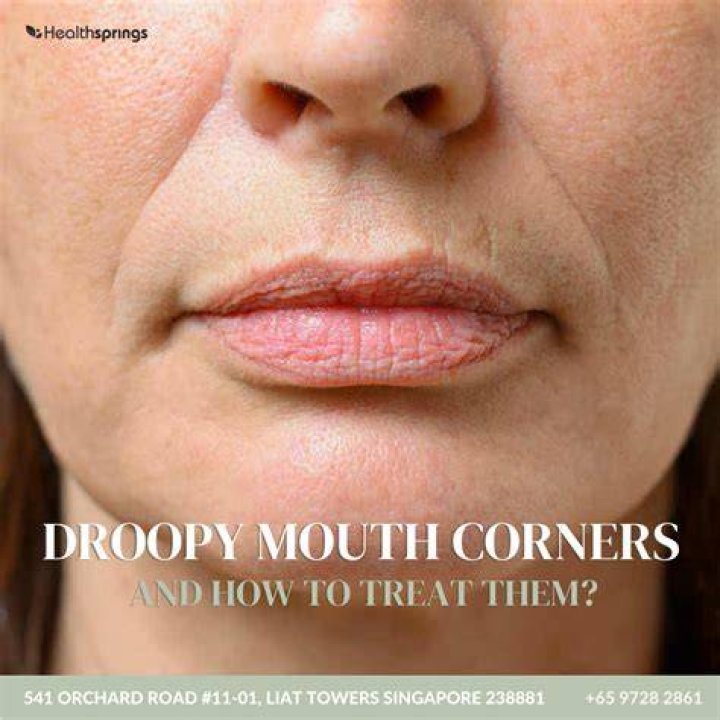 Why does my mouth droop down?