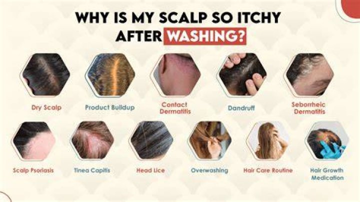 Why does my scalp itch after applying olive oil?