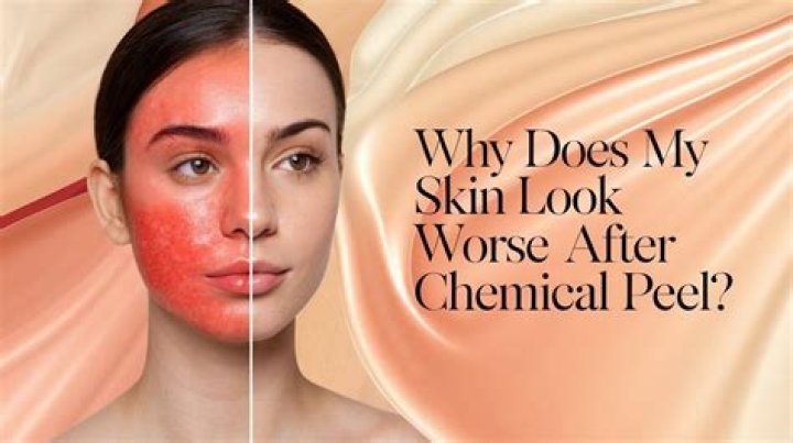 Why does my skin crawl?