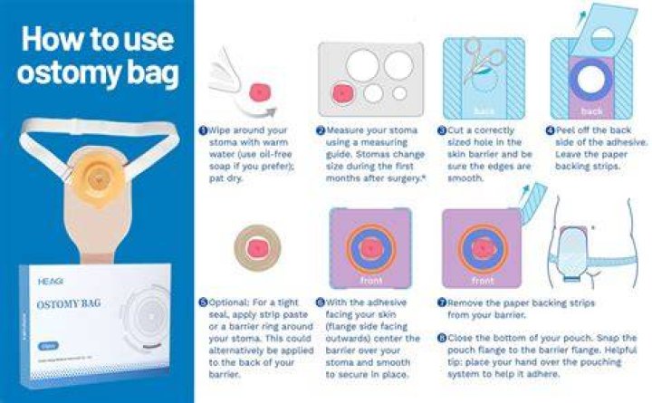 Why does my stoma bag keep bursting?