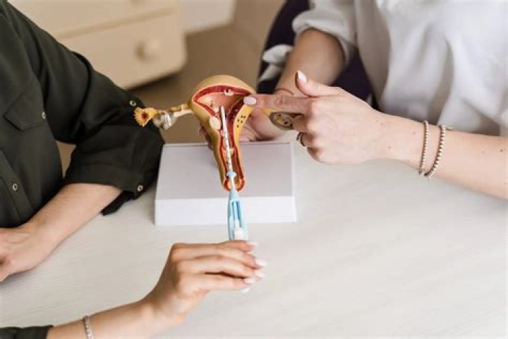 Why is an IUD better than the pill?