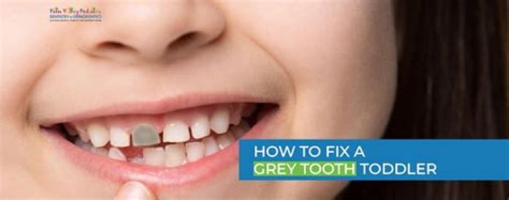 Why is my daughter's loose tooth turning GREY?