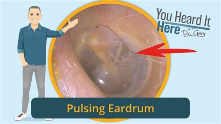 Why is my ear beating like a drum?