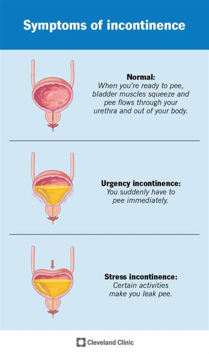 Why is my incontinence getting worse?