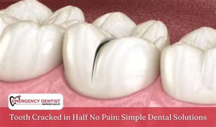 Why is my tooth cracked in half?