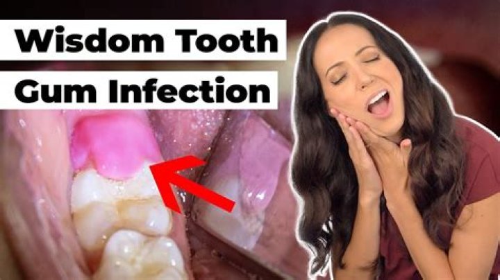 Why is my tooth growing out of my gum?