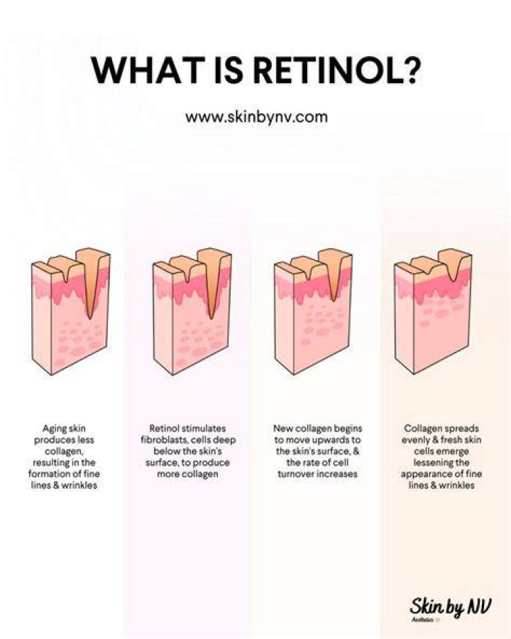 Why is retinol not working?