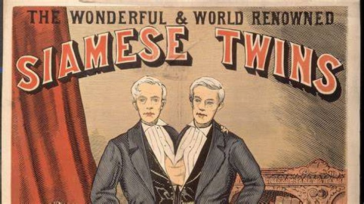 Why is Siamese twins offensive?