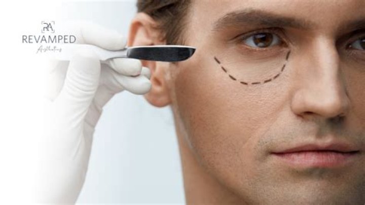 Why you should not Dermaplane?
